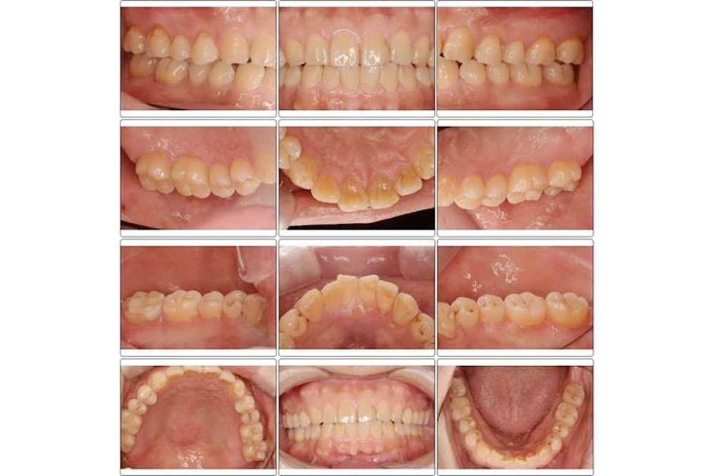 口腔内写真、レントゲン